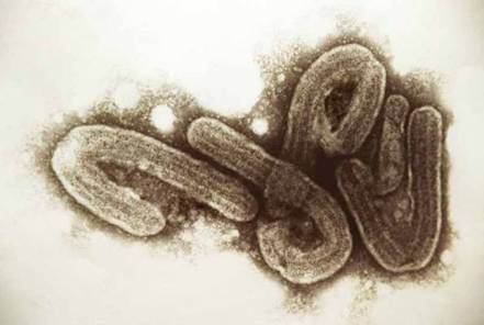 Ebola Virus